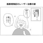 脂腺増殖症のレーザー治療の跡